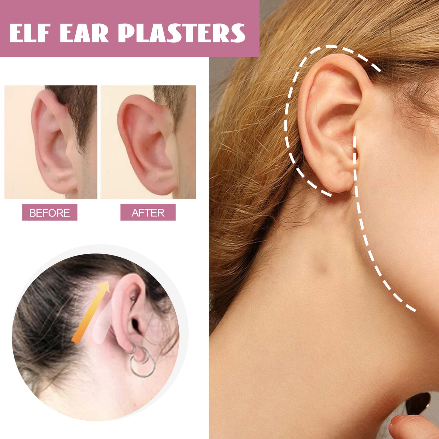 EELHOE elf ear veneer ear ear face small invisible breathable waterproof correction ear fixing patch