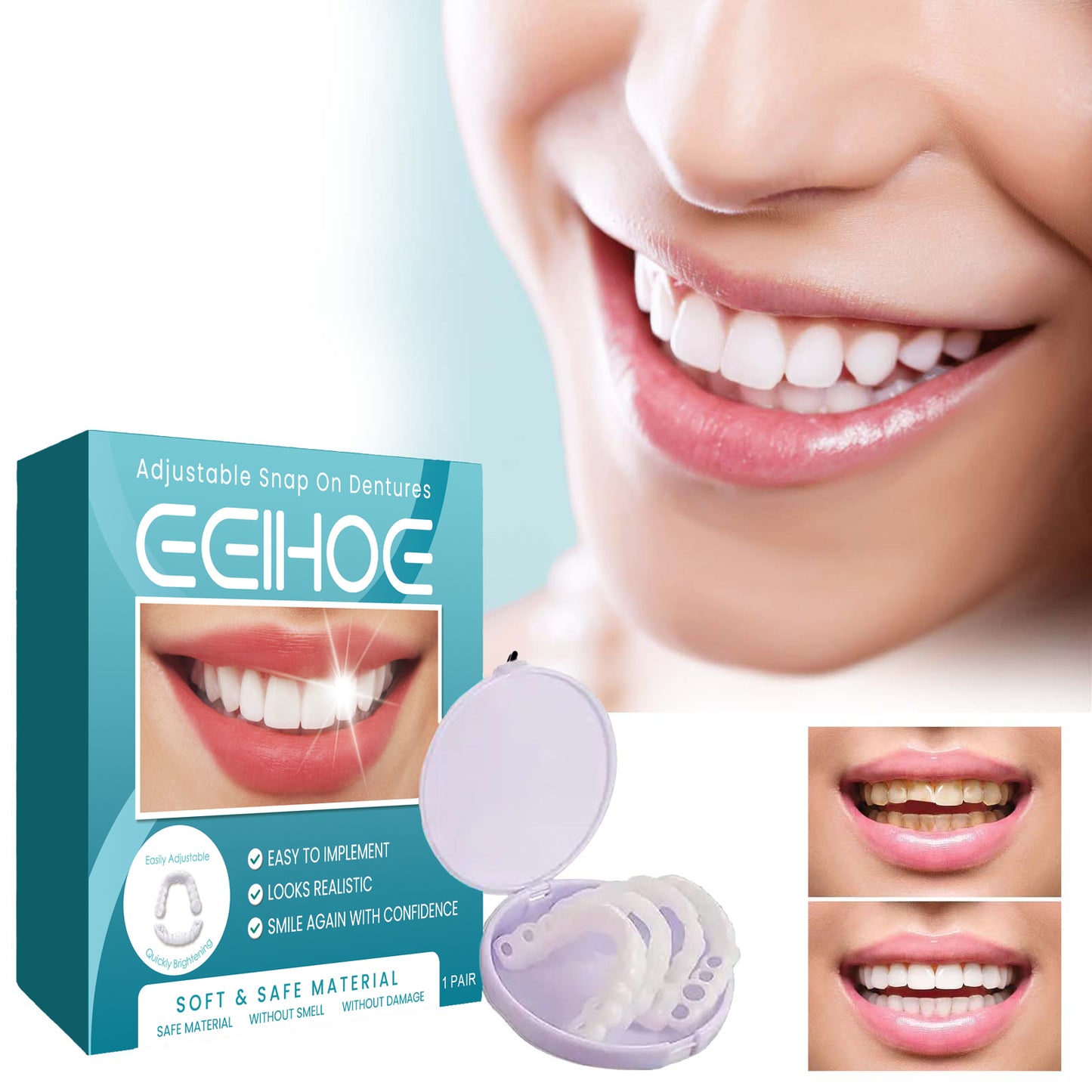 EELHOE adjustable snap-on denture temporary filling tooth gap filling orthodontic denture kit