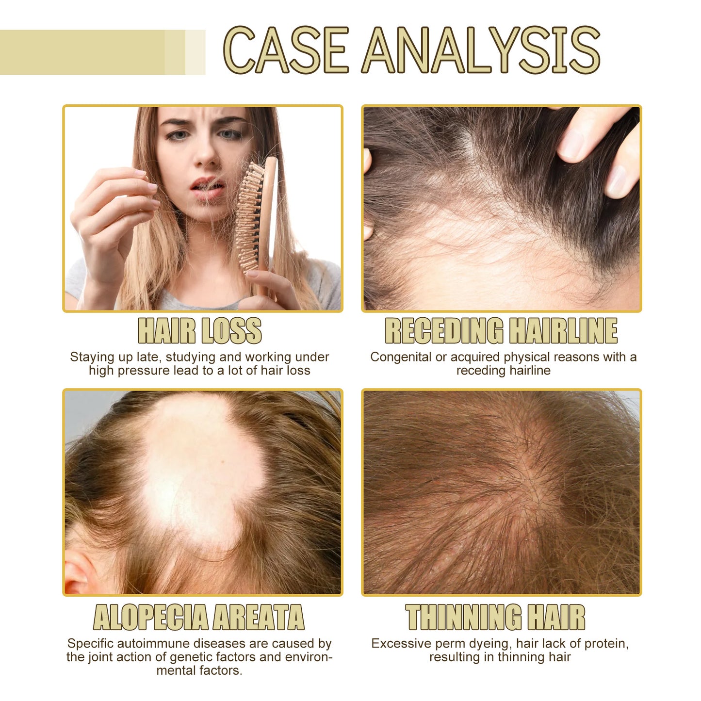 EELHOE Rosemary Hair Care Essential Oil Hair Repair Soft Hair Gentle Nourishing Gloss Hair Care Oil