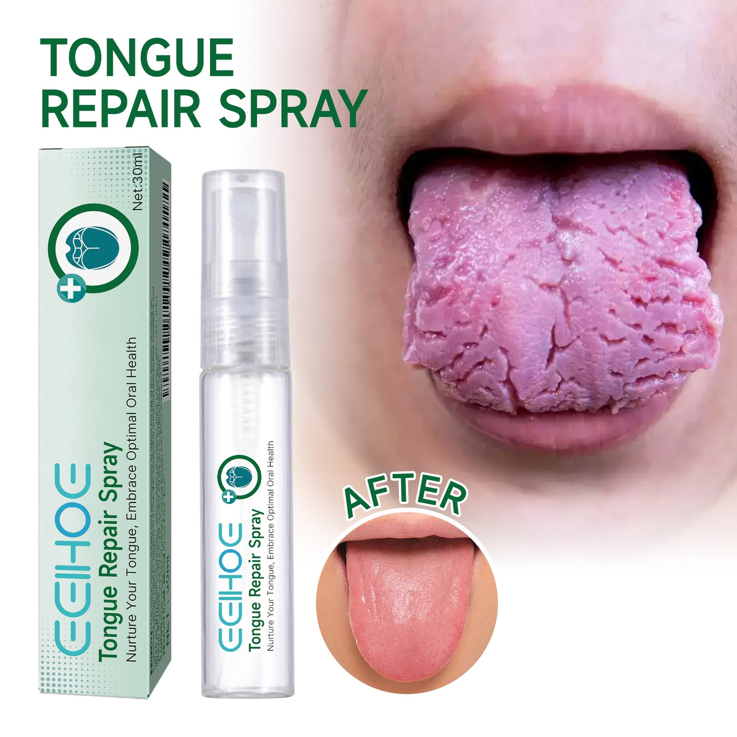 EELHOE Tongue Repair Spray to Repair Whiteness of Tongue Coating to Relieve Dry and Swelling of Tongue Oral Care Spray