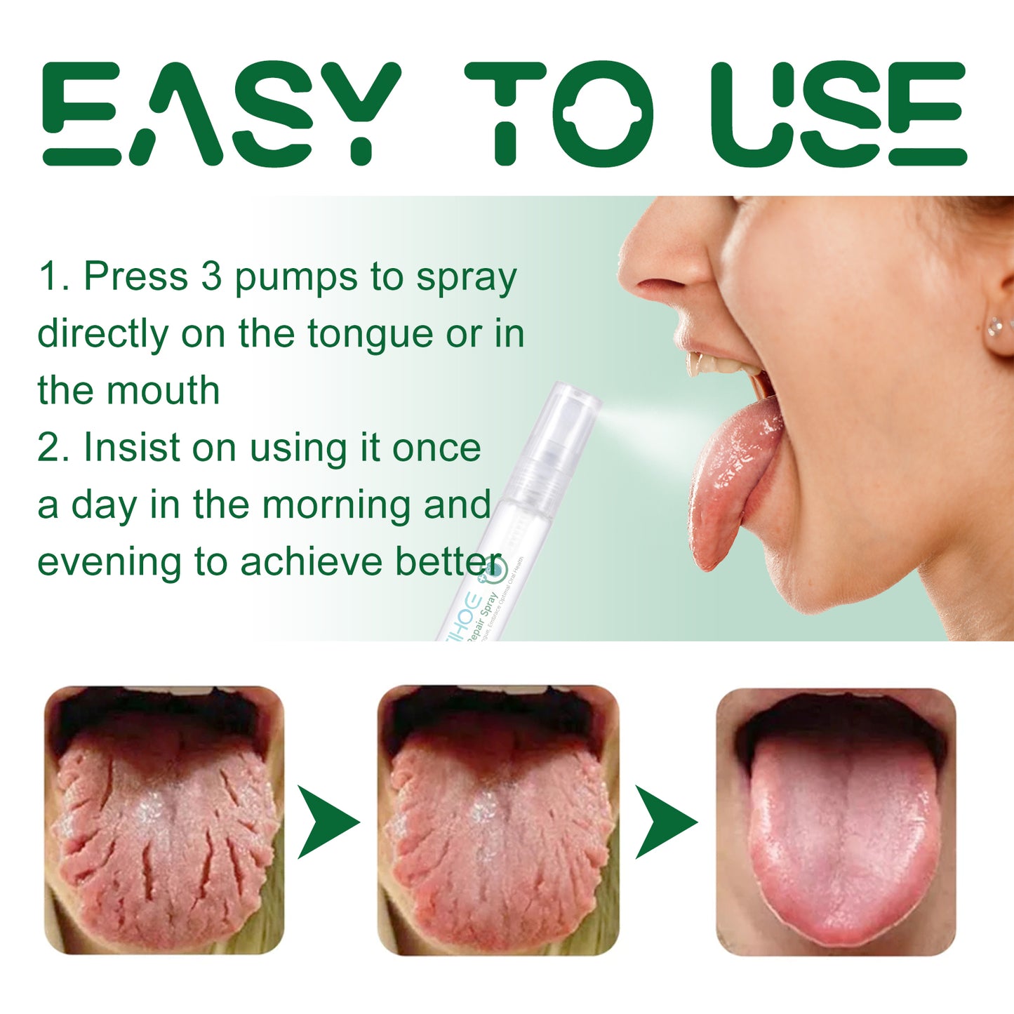 EELHOE Tongue Repair Spray to Repair Whiteness of Tongue Coating to Relieve Dry and Swelling of Tongue Oral Care Spray