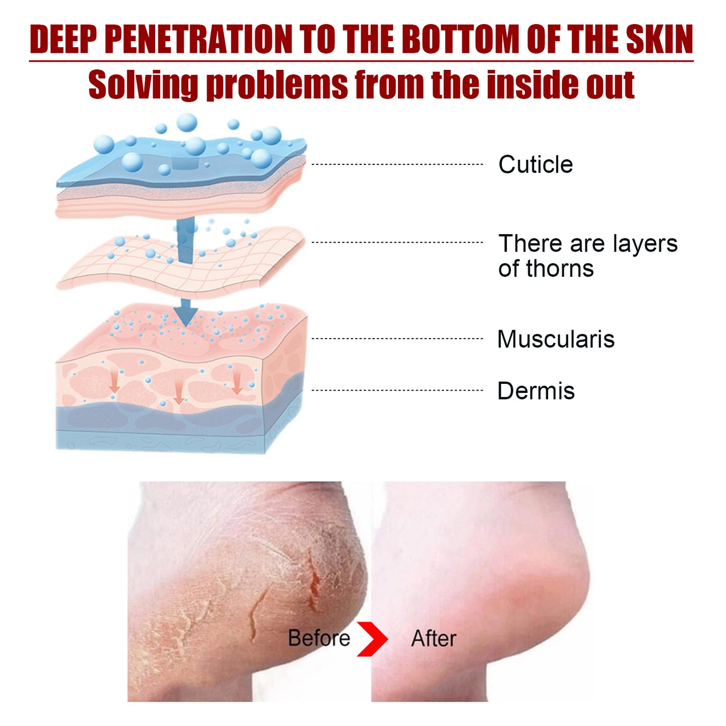 Jaysuing Acid Exfoliating Foot Mask Moisturizes and Rejuvenates Skin, Rejuvenates Calluses, Exfoliates Dead Skin, Hydrates and Moisturizes Foot