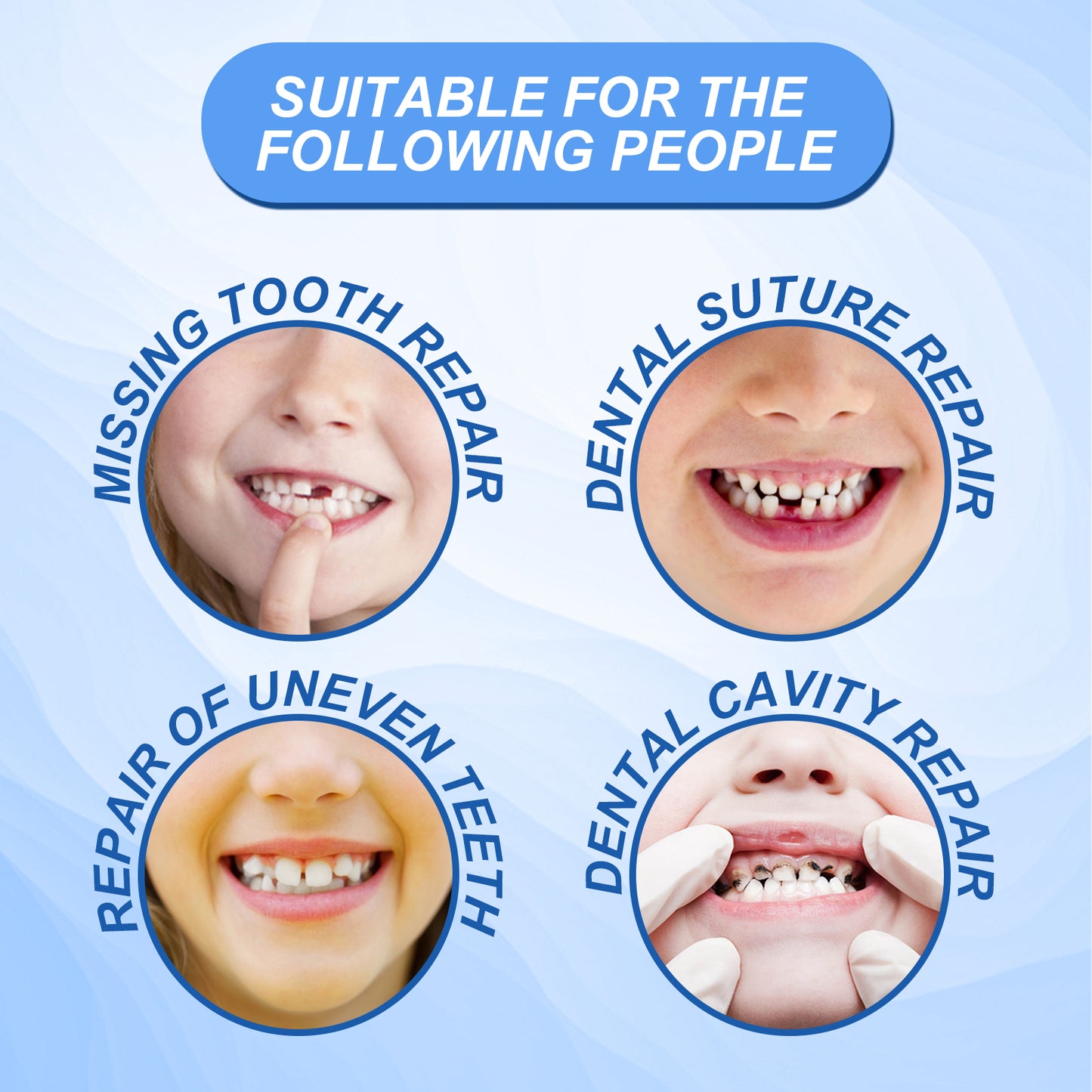 South Moon Solid Tooth Gel Modified Teeth Temporary Fillings Holes Fillings Glue Denture Gum