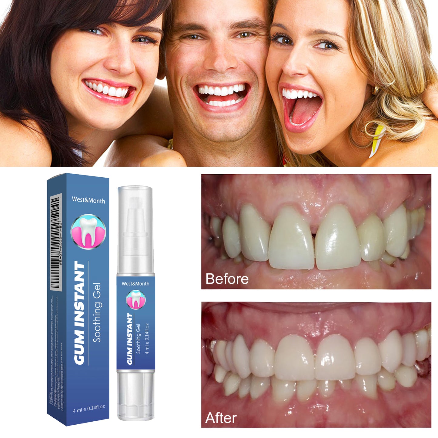 WestMonth Gum Care Gel Relieve Gum Swelling and Pain Cleaning Tooth Plaque Stains Whiten Tooth Gel