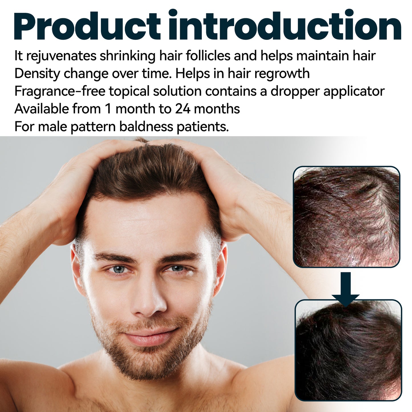 East Moon Men's Hair Concentrate Men's Hair Nutrition Care Anti-falling Hair Concentrate Moisturizing Essence