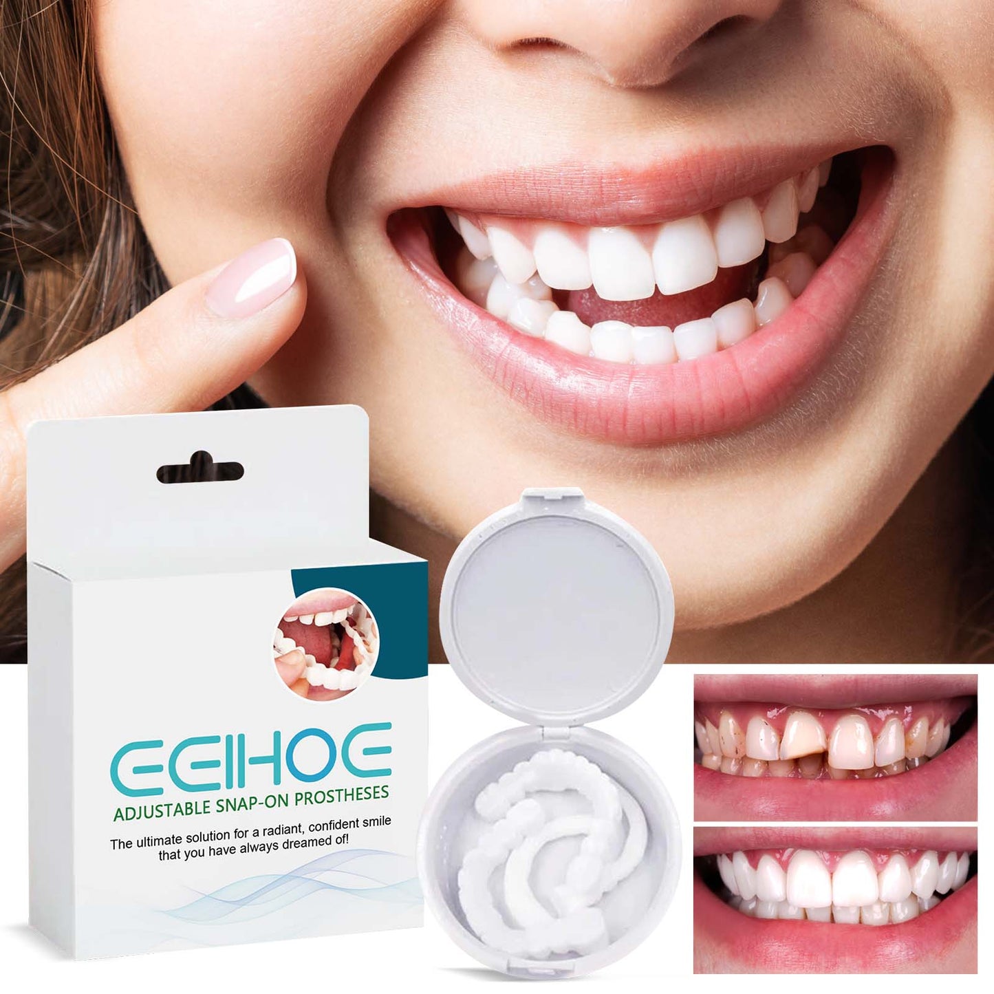 EELHOE adjustable snap-on denture modification teeth gap filling braces orthodontic denture kit