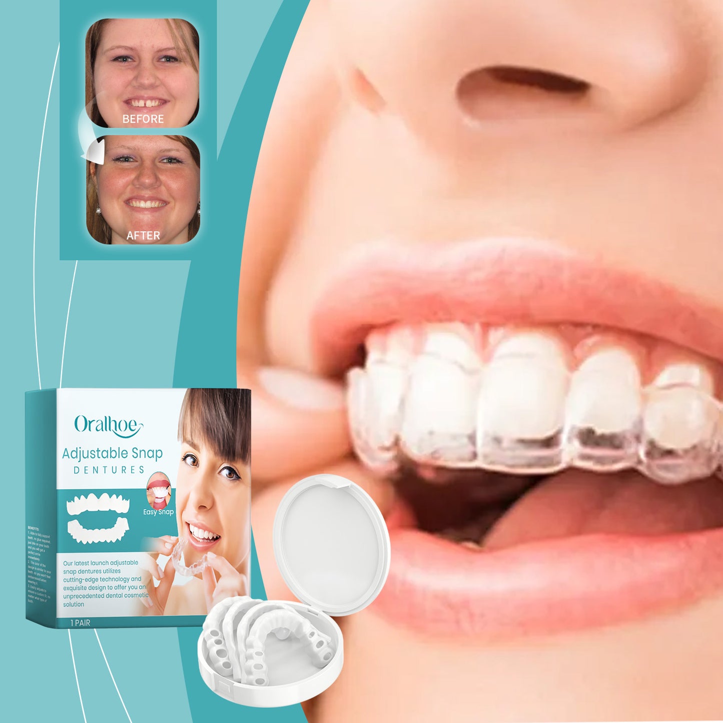 Oralhoe adjustable snap-on denture comfortable adjustable denture suitable for mouth chewing force to fit teeth