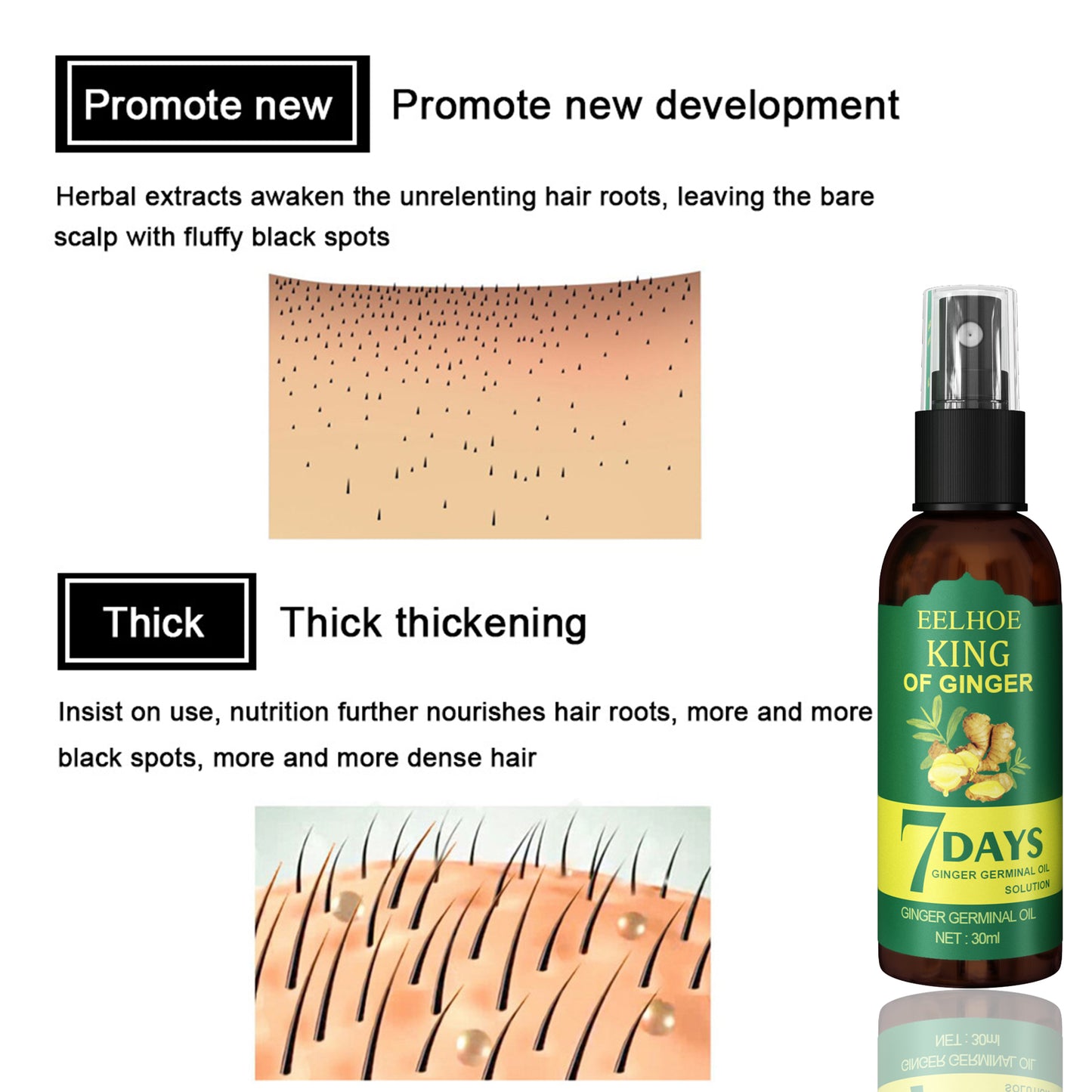 EELHOE Ginger Hair Spray (50ml Boxed) Strong Hair Massage Scalp Hair Repair Hair Care Solution