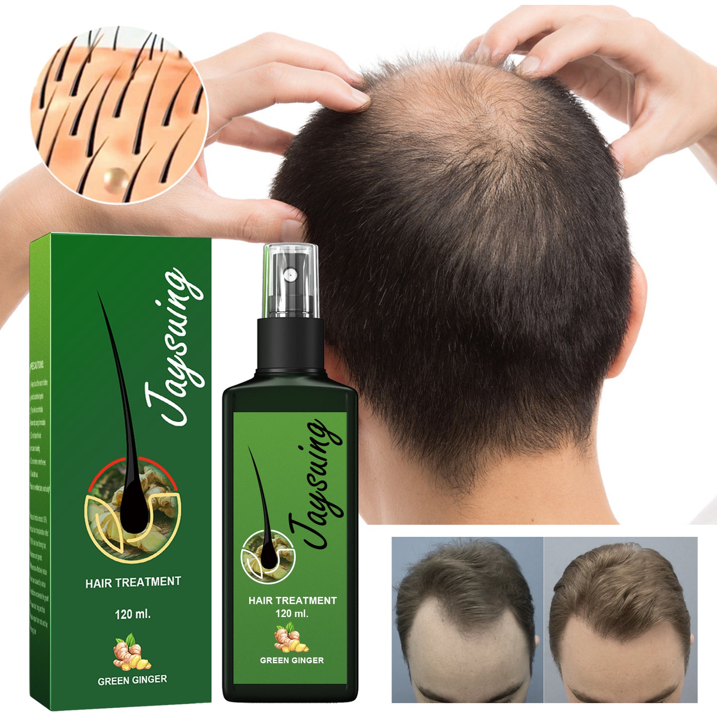 Jaysuing Hair Care Solution Gentle Nourishing Massage Scalp Moisturizing Soft Hair Hair Care Spray