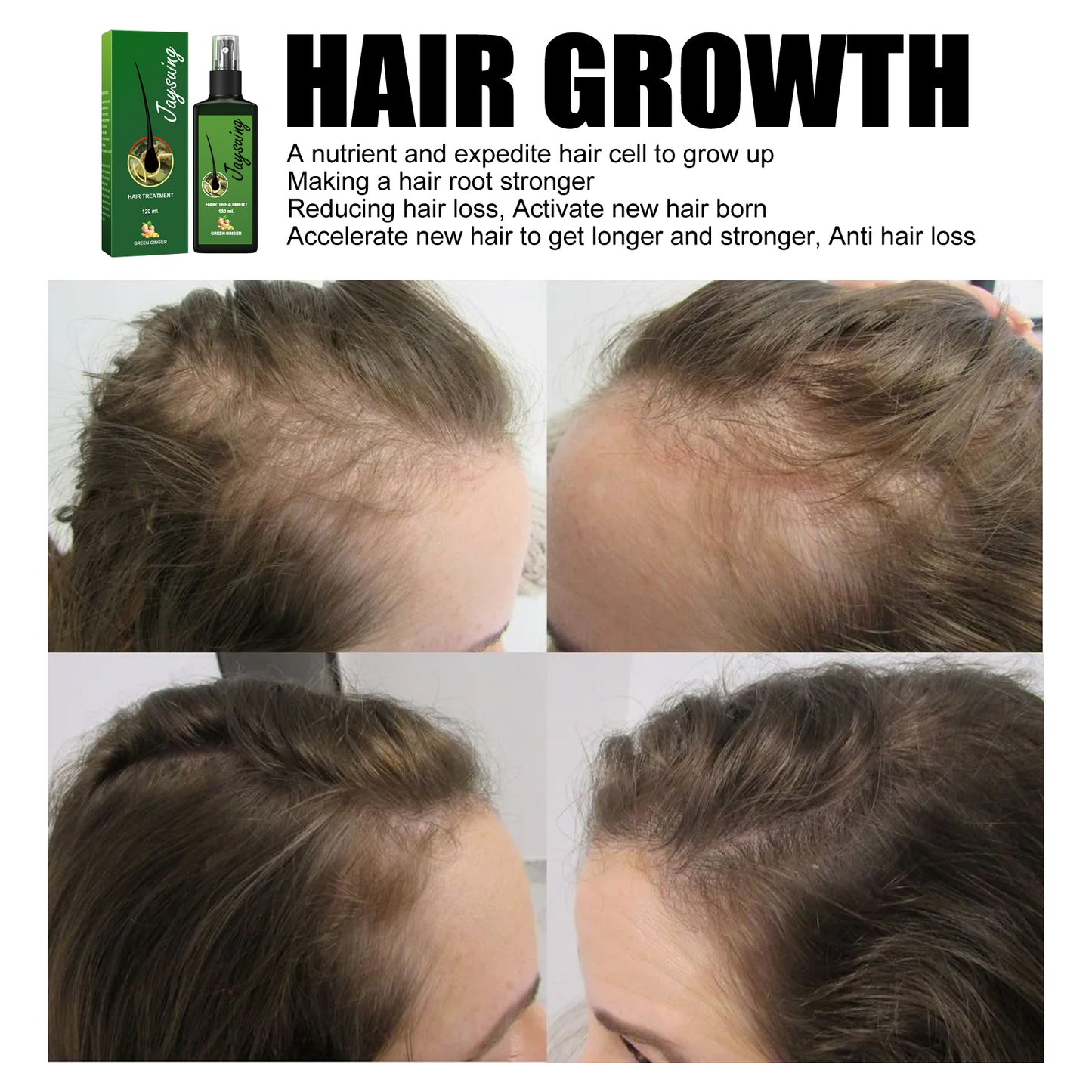 Jaysuing Hair Care Solution Gentle Nourishing Massage Scalp Moisturizing Soft Hair Hair Care Spray