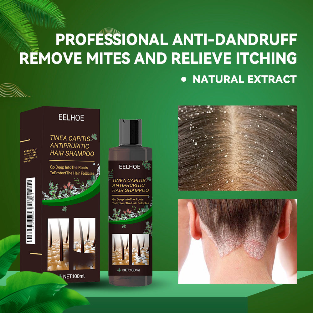 EELHOE Anti-itching Shampoo Anti-refreshing Oil Control Hair Care Anti-dandruff Anti-itching Shampoo