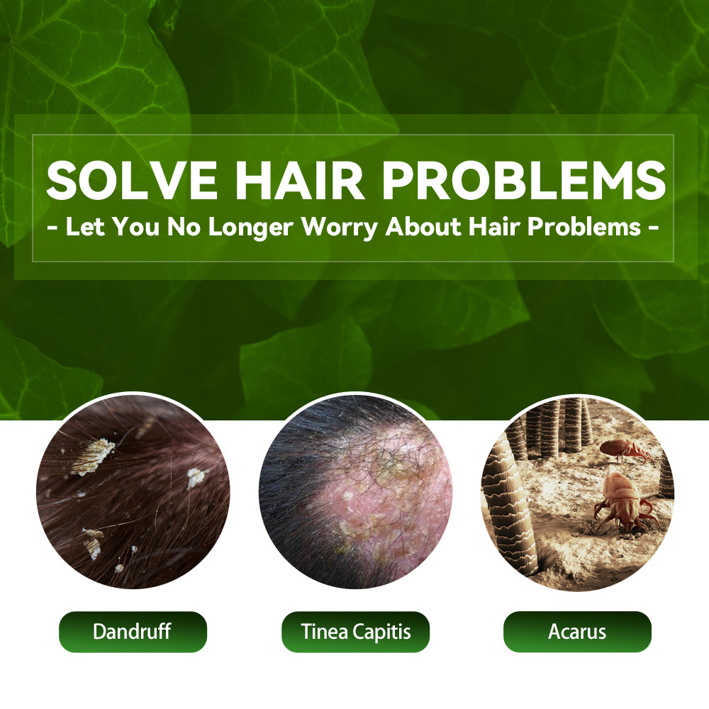 EELHOE Anti-itching Shampoo Anti-refreshing Oil Control Hair Care Anti-dandruff Anti-itching Shampoo