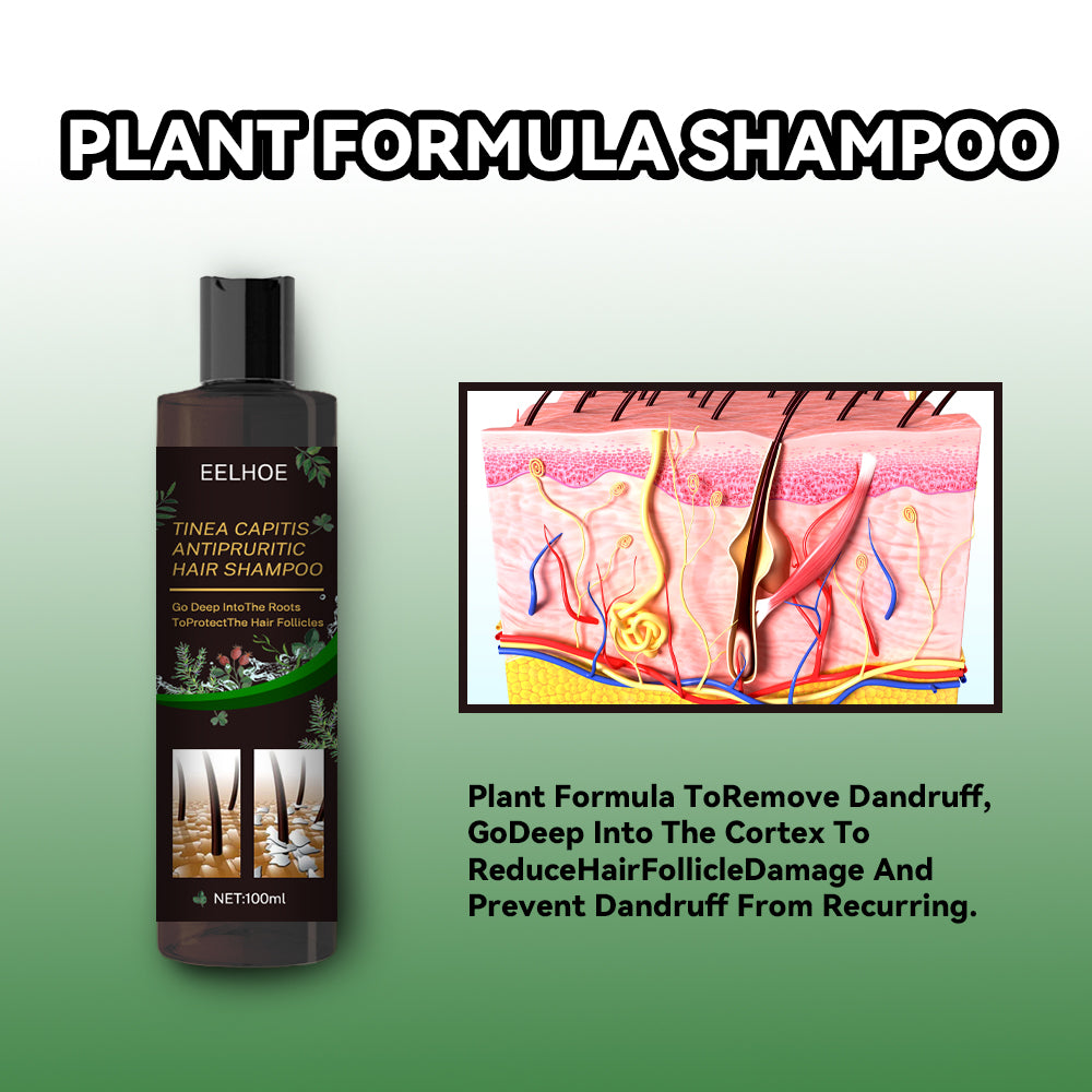 EELHOE Anti-itching Shampoo Anti-refreshing Oil Control Hair Care Anti-dandruff Anti-itching Shampoo